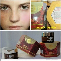 Kem vua khử nám  trị nám tàn nhang bị lâu năm hiệu quả 100%